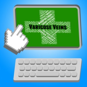 Varicose veins early symptoms